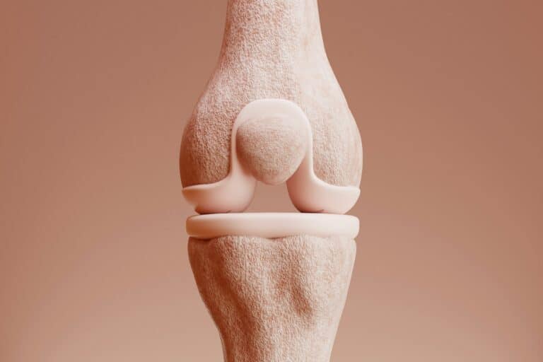 Arthrose du genou : que faire ?