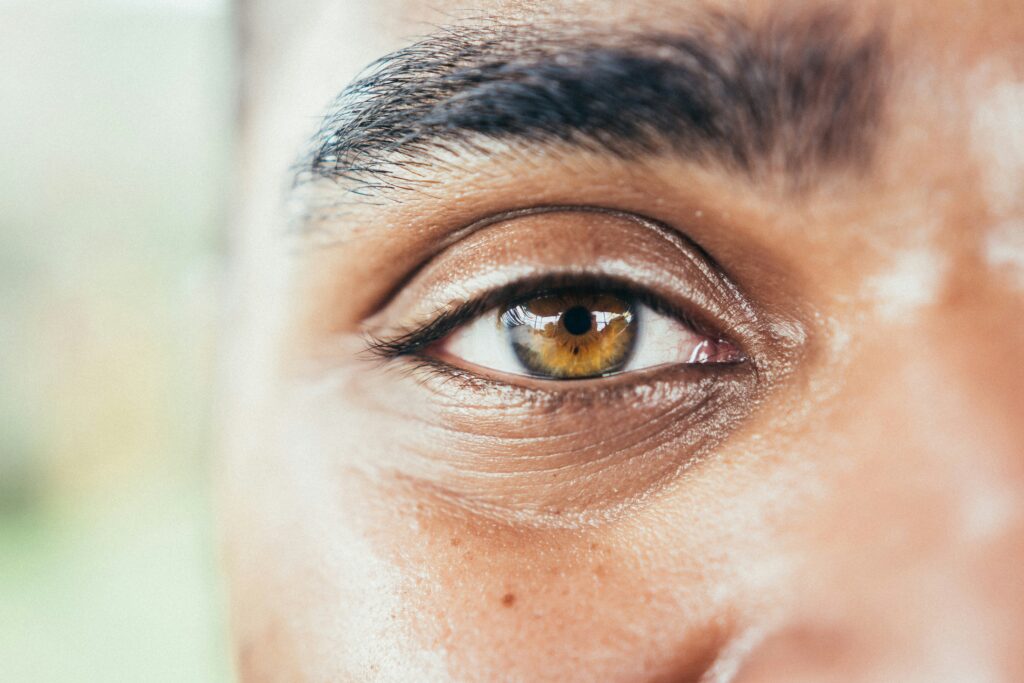 Poches sous les yeux : que faire ?
