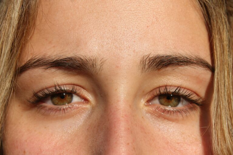 Poches sous les yeux : que faire ?